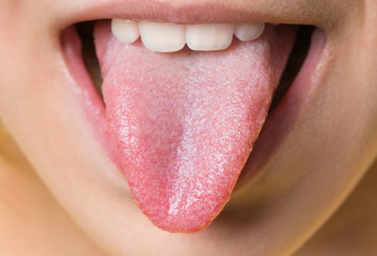 Білий наліт на язику: як лікувати і чому він з’являється?