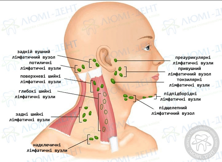 Як лікувати лімфовузли в домашніх умовах: поради та методи Як лікувати лімфовузли в домашніх умовах: поради та методи