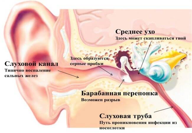 Що робити, коли болить вухо у дорослого: поради та рішення