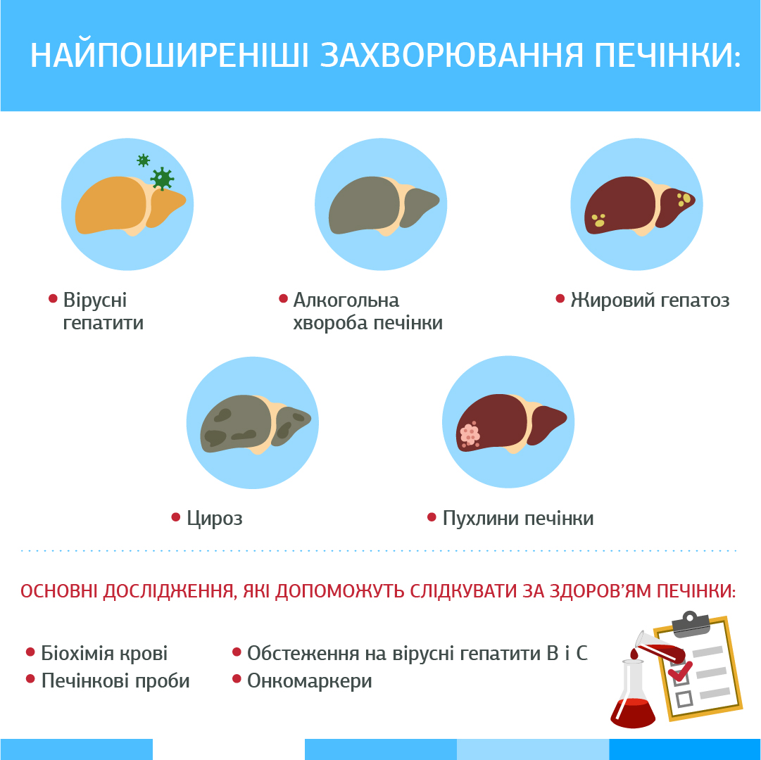 Що робити, коли болить печінка: симптоми та можливі причини.