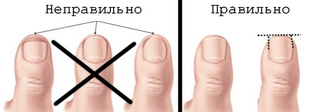 Як обрізати тверді нігті на ногах: поради та безпечні методи