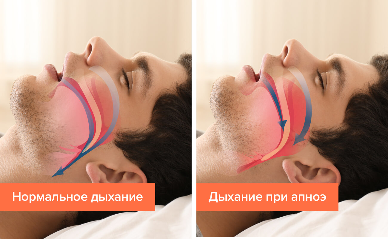 Причини: чому болить голова після сну і як це уникнути?