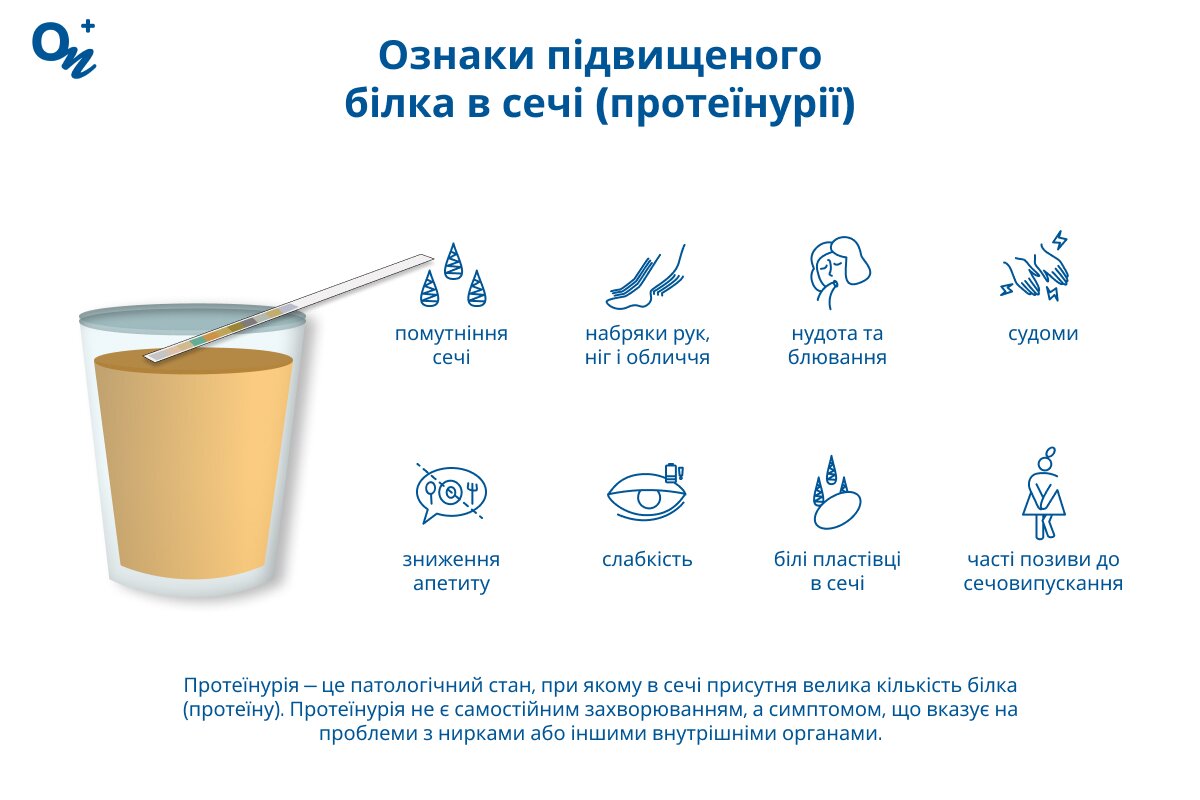 Як лікувати білок в сечі: ефективні методи та рекомендації