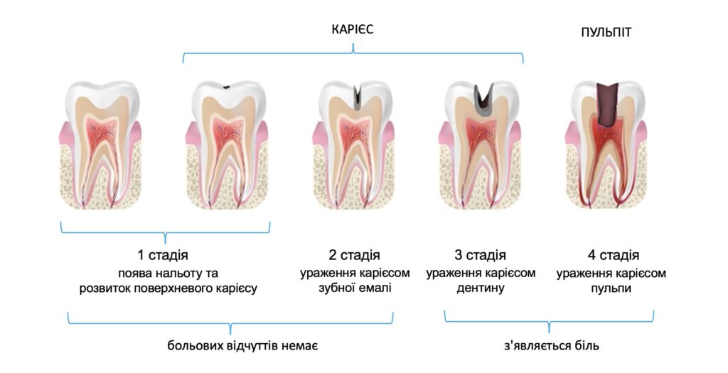 Що робити коли болить зуб вночі: поради для швидкого полегшення