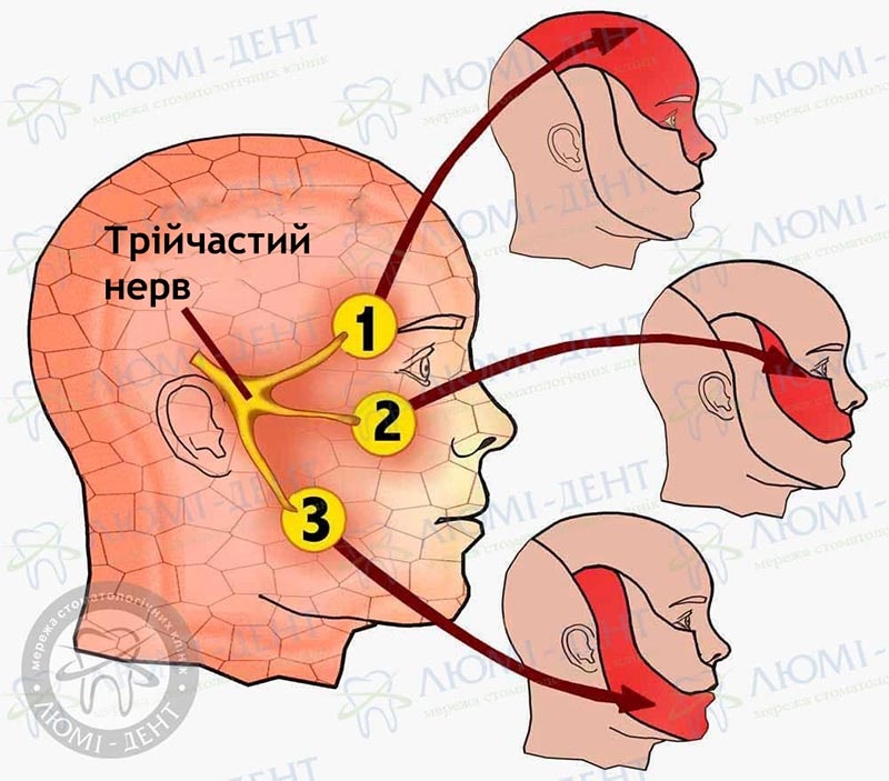Як лікувати трійчастий нерв в домашніх умовах: поради та методи